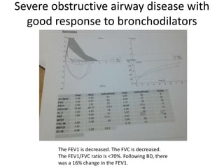 Severe obstructive airway disease with
good response to bronchodilators
The FEV1 is decreased. The FVC is decreased.
The FEV1/FVC ratio is <70%. Following BD, there
was a 16% change in the FEV1.
 