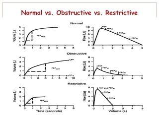 Normal vs. Obstructive vs. Restrictive
 