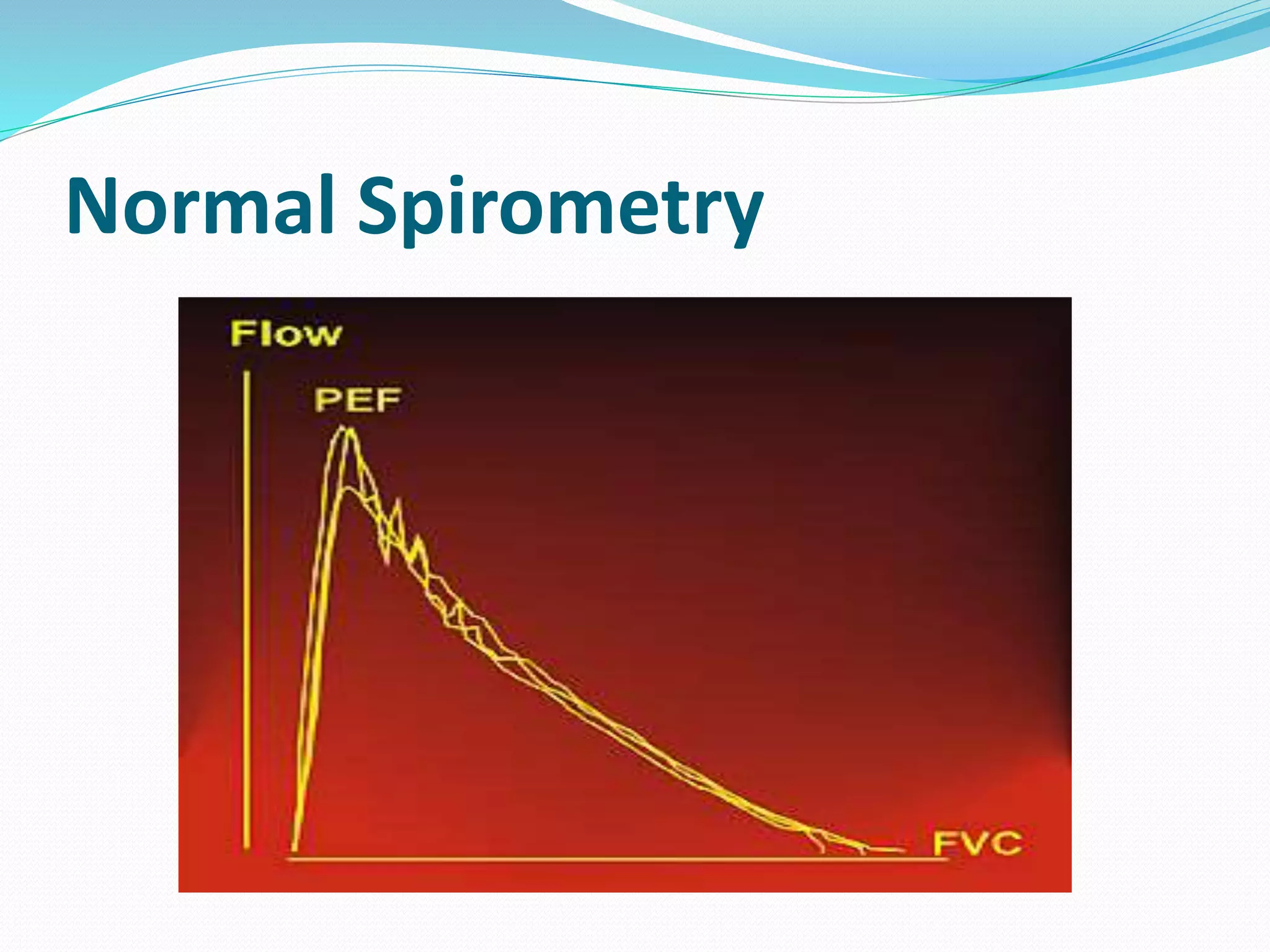 Normal Spirometry
 