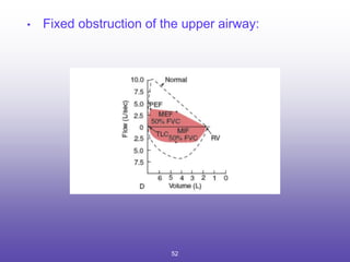 • Fixed obstruction of the upper airway:
52
 