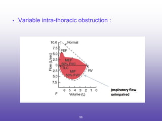 • Variable intra-thoracic obstruction :
56
 