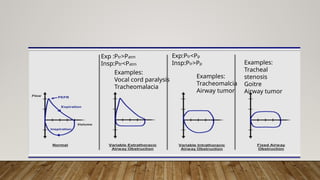 Exp :Ptr>Patm
Insp:Ptr<Patm
Exp:Ptr<Pp
Insp:Ptr>Pp
Examples:
Vocal cord paralysis
Tracheomalacia
Examples:
Tracheal
stenosis
Goitre
Airway tumor
Examples:
Tracheomalcia
Airway tumor
 