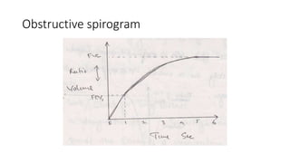 Obstructive spirogram
 