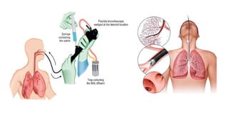 Pulmonary Function Tests and ABG analysis.pptx