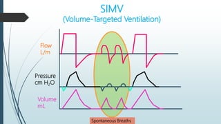 SIMV
(Volume-Targeted Ventilation)
Spontaneous Breaths
Flow
L/m
Pressure
cm H2O
Volume
mL
 