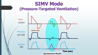 Pressure
Flow
Volume
(L/min)
(cm H2O)
(ml)
Set PC level
Time (sec)
SIMV Mode
(Pressure-Targeted Ventilation)
Spontaneous Breath
 