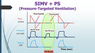 Pressure
Flow
Volume
(L/min)
(cm H2O)
(ml)
SIMV + PS
(Pressure-Targeted Ventilation)
PS Breath
Set PS level
Set PC level
Time (sec)
Time-Cycled Flow-Cycled
 