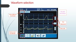 Waveform selection
Push to start
waveforms
Time scale
Size
adjustment
Select different
waveforms
PB 840
Ventilator
 