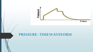 PRESSURE–TIMEWAVEFORM
 