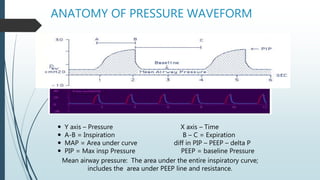 ANATOMY OF PRESSURE WAVEFORM
 Y axis – Pressure X axis – Time
 A-B = Inspiration B – C = Expiration
 MAP = Area under curve diff in PIP – PEEP – delta P
 PIP = Max insp Pressure PEEP = baseline Pressure
Mean airway pressure: The area under the entire inspiratory curve;
includes the area under PEEP line and resistance.
 