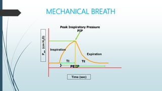 MECHANICAL BREATH
Inspiration
Expiration
P
aw
(cm
H
2
O)
Time (sec)
}
TI
Peak Inspiratory Pressure
PIP
PEEP
TE
 