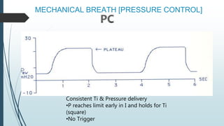 MECHANICAL BREATH [PRESSURE CONTROL]
Consistent Ti & Pressure delivery
•P reaches limit early in I and holds for Ti
(square)
•No Trigger
 