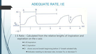 ADEQUATE RATE, I:E
I: E Ratio - Calculated from the relative lengths of inspiration and
expiration on the x-axis
A-B Inspiration
B-C Expiration
D shows second breath beginning before 1st breath exhaled fully
Indicates needing to decrease rate, increase Te, or decrease Ti
 