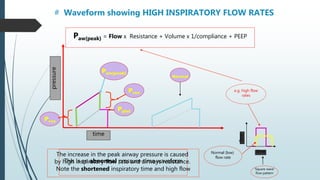 # Waveform showing HIGH INSPIRATORY FLOW RATES
This is an abnormal pressure-time waveform
time
pressure
Paw(peak)
Pres
Pplat
Pres
The increase in the peak airway pressure is caused
by high inspiratory flow rate and airways resistance.
Note the shortened inspiratory time and high flow
e.g. high flow
rates
Paw(peak) = Flow x Resistance + Volume x 1/compliance + PEEP
time
flow
‘Square wave’
flow pattern
Normal
Normal (low)
flow rate
 