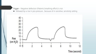 Trigger – Negative deflection (Patients breathing effort) is not
 followed by a rise in pos pressure , because of in-sensitive, sensitivity setting
 