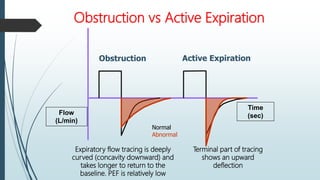 Obstruction vs Active Expiration
Obstruction Active Expiration
Time
(sec)
Normal
Abnormal
Flow
(L/min)
Expiratory flow tracing is deeply
curved (concavity downward) and
takes longer to return to the
baseline. PEF is relatively low
Terminal part of tracing
shows an upward
deflection
 
