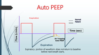Auto PEEP
Inspiration
Expiration
Normal
Patient
Time (sec)
Flow
(L/min)
Air Trapping
Auto-PEEP
}
Expiratory portion of waveform does not return to baseline
before next breath starts.
 