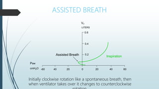 ASSISTED BREATH
Inspiration
0 20 40 60
20
40
-60
0.2
LITERS
0.4
0.6
Paw
cmH2O
Assisted Breath
VT
Initially clockwise rotation like a spontaneous breath, then
when ventilator takes over it changes to counterclockwise
 