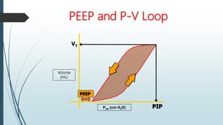 PEEP and P-V Loop
Volume
(mL)
VT
PIP
Paw (cm H2O)
PEEP
 