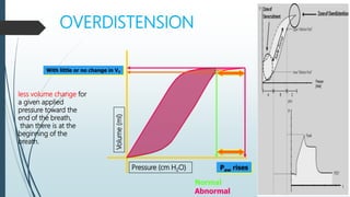 OVERDISTENSION
Volume
(ml)
Pressure (cm H2O)
With little or no change in VT
Paw rises
Normal
Abnormal
less volume change for
a given applied
pressure toward the
end of the breath,
than there is at the
beginning of the
breath.
 