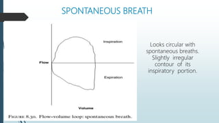 SPONTANEOUS BREATH
Looks circular with
spontaneous breaths.
Slightly irregular
contour of its
inspiratory portion.
 
