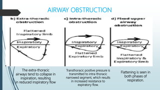 AIRWAY OBSTRUCTION
The extra-thoracic
airways tend to collapse in
inspiration, resulting
in reduced inspiratory flow
Transthoracic positive pressure is
transmitted to intra-thoracic
narrowed segment, which results
in increased resistance to
expiratory flow.
Flattening is seen in
both phases of
respiration.
 