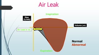 Air Leak
Inspiration
Expiration
Volume (ml)
Flow
(L/min)
Air Leak in mL
Normal
Abnormal
 