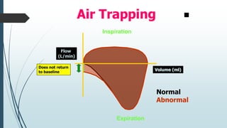 Air Trapping
Inspiration
Expiration
Volume (ml)
Flow
(L/min)
Does not return
to baseline
Normal
Abnormal
 