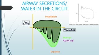 AIRWAY SECRETIONS/
WATER IN THE CIRCUIT
Inspiration
Expiration
Volume (ml)
Flow
(L/min)
Normal
Abnormal
 