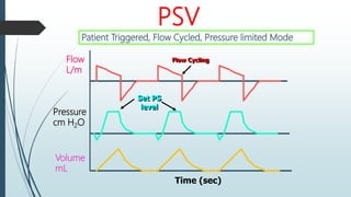 PSV
Time (sec)
Flow
L/m
Pressure
cm H2O
Volume
mL
Flow Cycling
Set PS
level
Patient Triggered, Flow Cycled, Pressure limited Mode
 