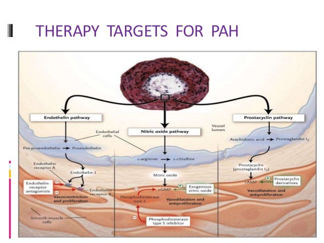 Prostacyclins and persistent pulmonary hypertension