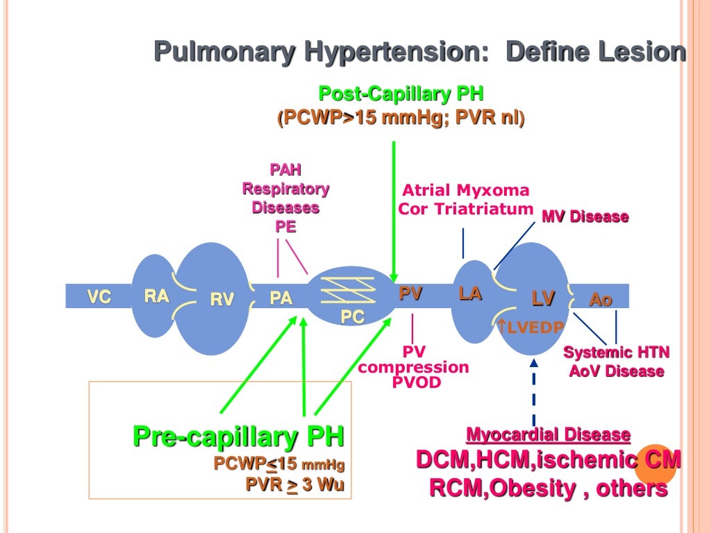 Pulmonary hypertension and anesthesia