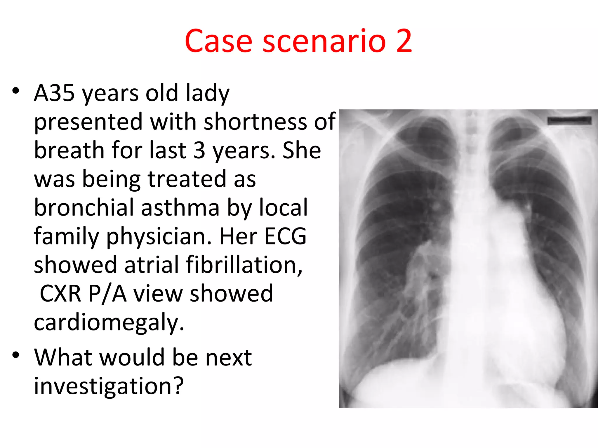 Pulmonary hypertension dr md toufiqur rahman dm fcps frcp fesc faha ...