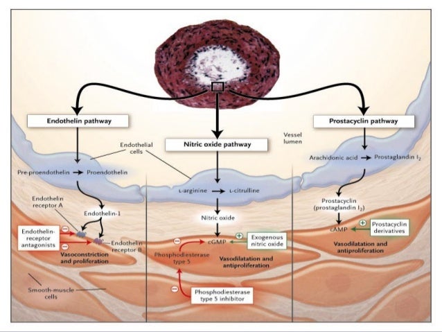 etiology and pathophysiology of arterial hypertension