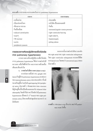 Vol.10No.2IJM
เมษายน - มิถุนายน 2554ปีที่ 10 ฉบับที่ 2
ว า ร ส า ร อ า ยุ ร ศ า ส ต ร์ อี ส า น10
ตารางที่ 1 อาการและอาการแสดงในภาวะ pulmonary hypertension
อาการ อาการแสดง
- เหนื่อยง่าย
- เจ็บแน่นหน้าอก
- ท้องมาน ขาบวม
- ไอเป็นเลือด
- reduced carotid pulse
- loud P2
- TR murmur
- ascitis
- peripheral cyanosis
- อ่อนเพลีย
- หน้ามืด เป็นลมหมดสติ
- ใจสั่น
- increased jugular venous pressure
- right ventricular heaving
- right-sided S4
- hepatomegaly
- pitting edema
การตรวจทางห้องปฏิบัติการเพื่อวินิจฉัย
ภาวะ pulmonary hypertension
	 การตรวจทางห้องปฏิบัติการเพื่อวินิจฉัย
ภาวะ pulmonary hypertension ได้แก่ ภาพถ่ายรังสี
ทรวงอก คลื่นไฟฟ้าหัวใจ และการตรวจด้วยคลื่น
เสียงสะท้อนหัวใจ
	 1.	 ภาพถ่ายรังสีทรวงอก (chest x-ray)
	 	 ควรส่งตรวจทั้งท่า PA upright และ
lateralในผู้ป่วยpulmonaryhypertensionจะพบเงา
ของmainpulmonaryarteryและแขนงหลัก2ข้างมี
ขนาดใหญ่ขึ้นร่วมกับมีrapidtaperingของperiphe-
ral artery ดังภาพที่ 1 ลักษณะของ hilar structure
ที่ดูใหญ่ขึ้นนี้จำ�เป็นต้องแยกแยะกับ bilateral hilar
adenopathyโดยทั่วไปเราจะวินิจฉัยว่ามีpulmonary
hypertension เมื่อพบว่า 2nd
branch ของ right pul-
monary artery มีขนาดเส้นผ่าศูนย์กลางมากกว่า 16
มิลลิเมตร
	 	 นอกจากนั้นภาพถ่ายรังสีทรวงอกยัง
พบ right atrial และ right ventricular enlargement
โดย right ventricular enlargement จะบอกได้ชัด
จากlateralviewโดยพบว่าretrosternalspaceลดลง
ดังภาพที่ 2
ภาพที่ 1	ภาพ chest x-ray ด้าน PA พบว่ามี pulmo-
	 nary trunk โตขึ้น
ภาพที่ 1 ภาพ chest x-ray ดาน PA พบวามี pulmonary trunk โตขึ้น
 