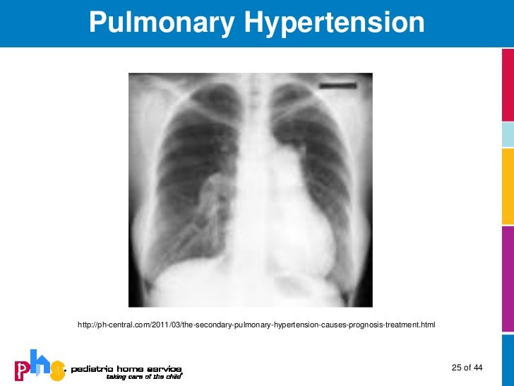Pulmonary Hypertensionvin Infants and Children