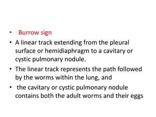 Pulmonary infections | PPTX