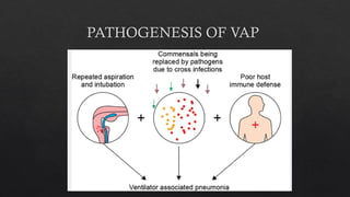 ROLE OF RADIOLOGY IN PULMONARY INFECTIONS | PPTX