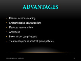 ADVANTAGES
• Minimal incisions/scarring
• Shorter hospital stay/outpatient
• Reduced recovery time
• Anesthetic
• Lower risk of complications
• Treatment option in poor/risk prone patients
PUL.INTERVENTIONAL RADIOLOGY 41
 