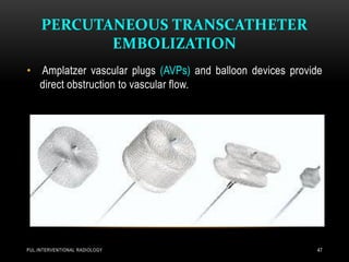 PERCUTANEOUS TRANSCATHETER
EMBOLIZATION
PUL.INTERVENTIONAL RADIOLOGY 47
• Amplatzer vascular plugs (AVPs) and balloon devices provide
direct obstruction to vascular flow.
 