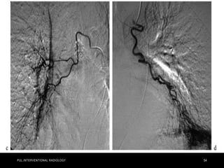 PUL.INTERVENTIONAL RADIOLOGY 54
 