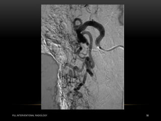 PUL.INTERVENTIONAL RADIOLOGY 56
 