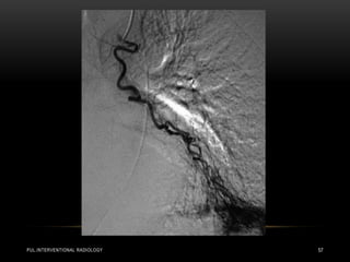 PUL.INTERVENTIONAL RADIOLOGY 57
 