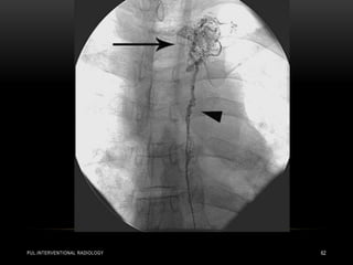PUL.INTERVENTIONAL RADIOLOGY 62
 