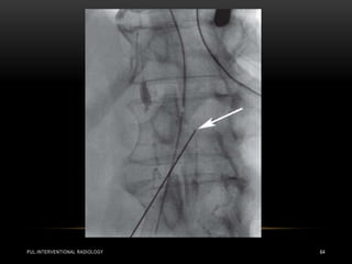 PUL.INTERVENTIONAL RADIOLOGY 64
 