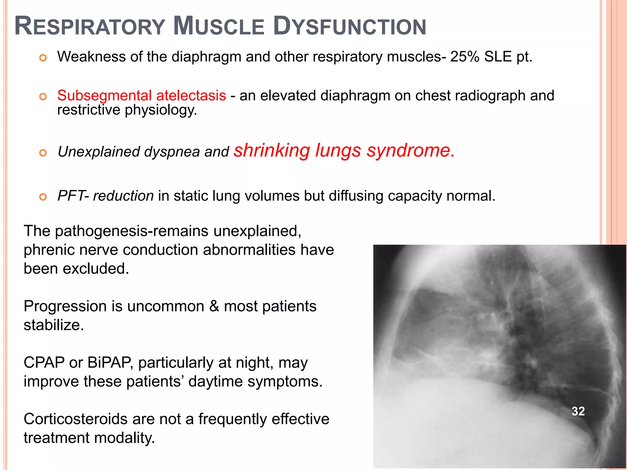 Pulmonary manifestations of collagen vascular diseases | PPTX