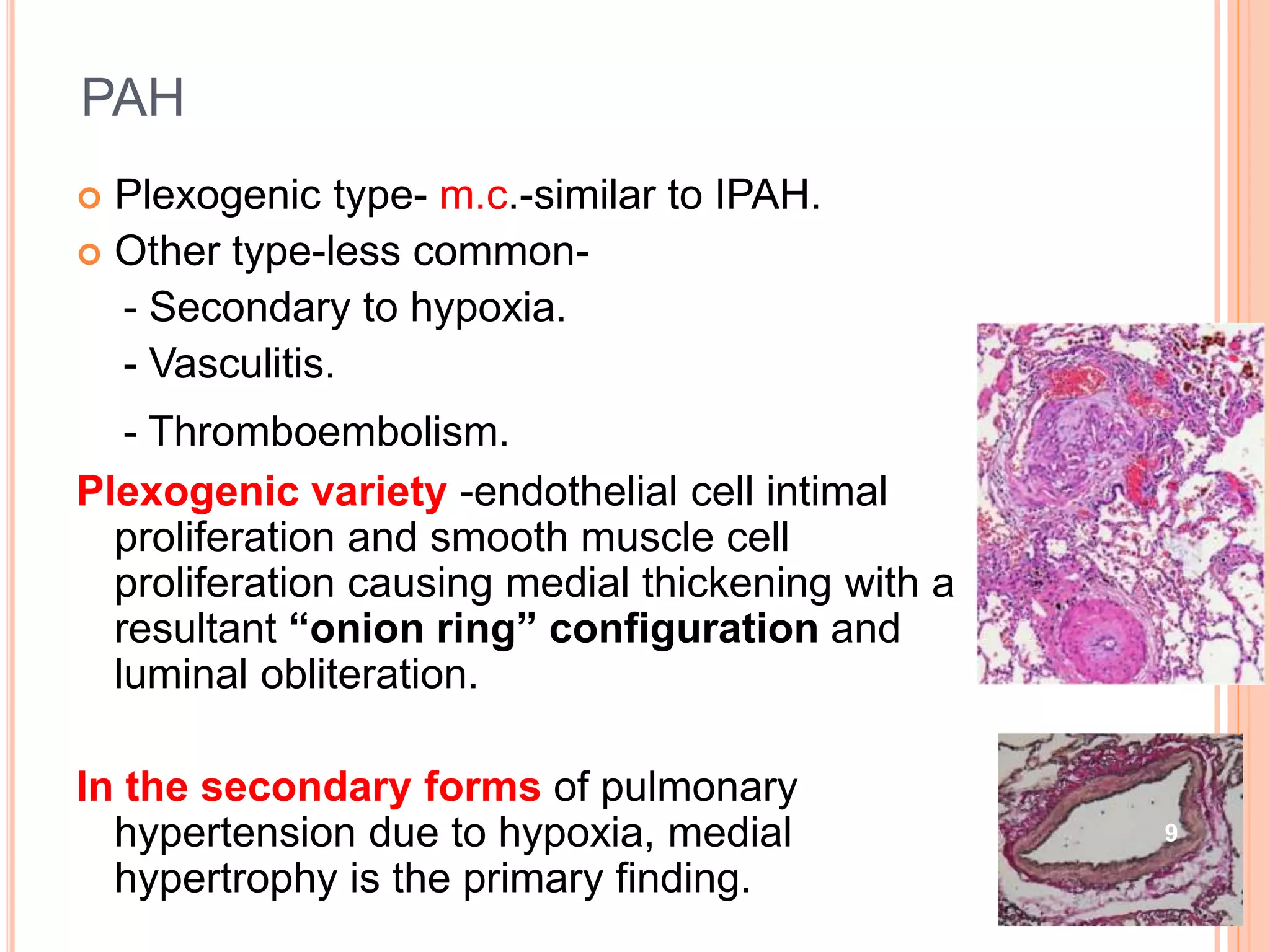 Pulmonary manifestations of collagen vascular diseases | PPTX