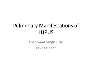 Pulmonary Manifestations of
LUPUS
Mohmeet Singh Brar
PG Resident
 