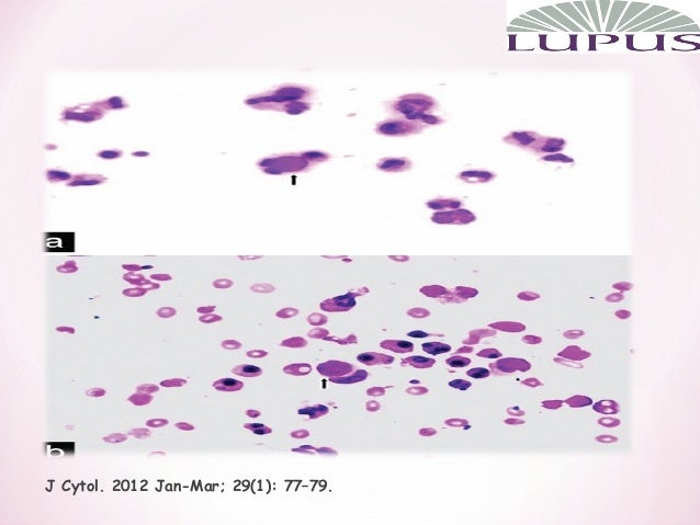 ebook microbial production of food ingredients enzymes