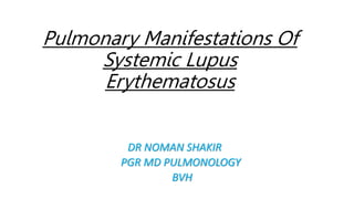 Pulmonary Manifestations Of
Systemic Lupus
Erythematosus
DR NOMAN SHAKIR
PGR MD PULMONOLOGY
BVH
 